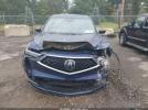 Acura MDX Technology Package Image 4